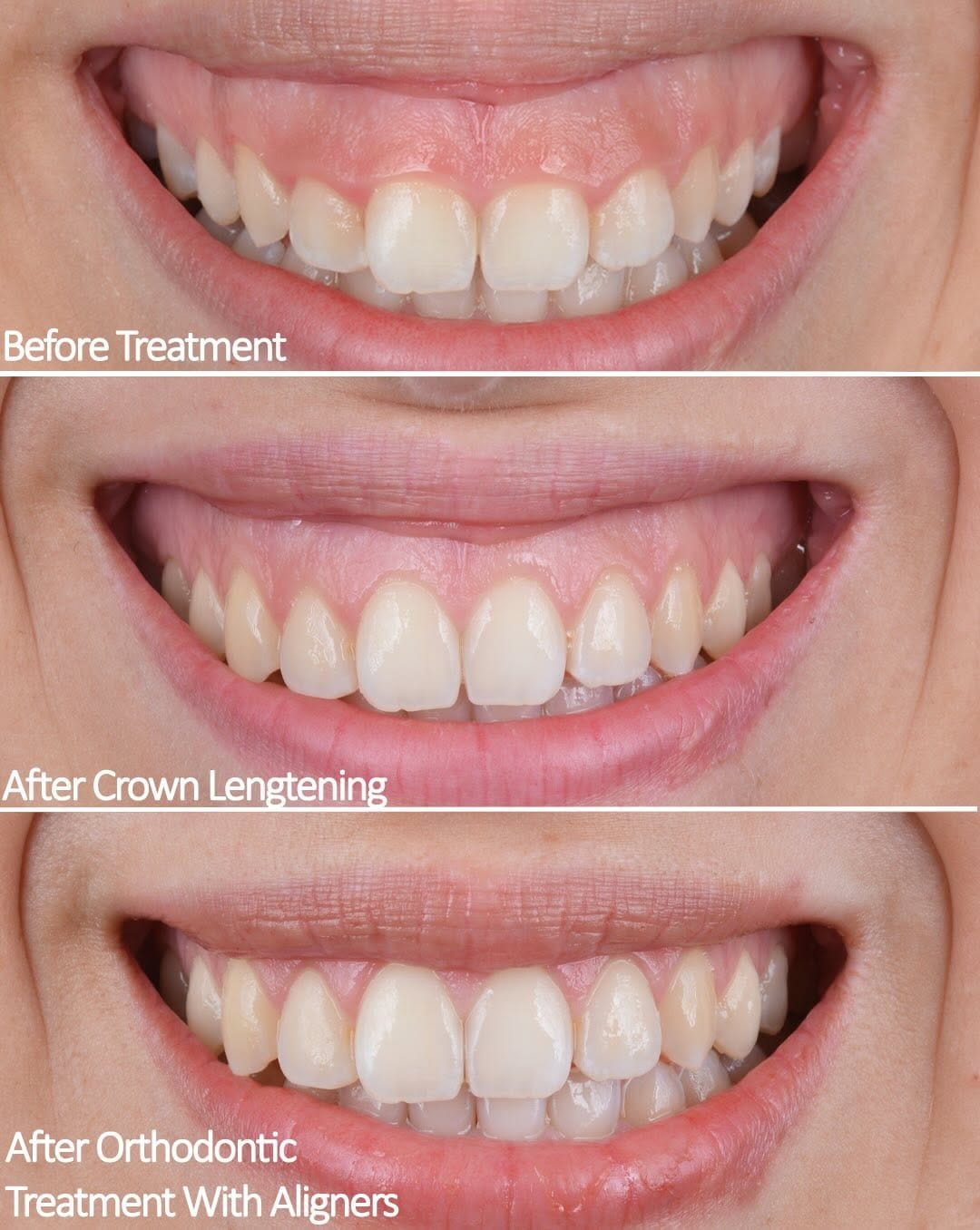 Post 3 by Dr Dr Esra Bozbay Özsoy on Instagram (carousel)