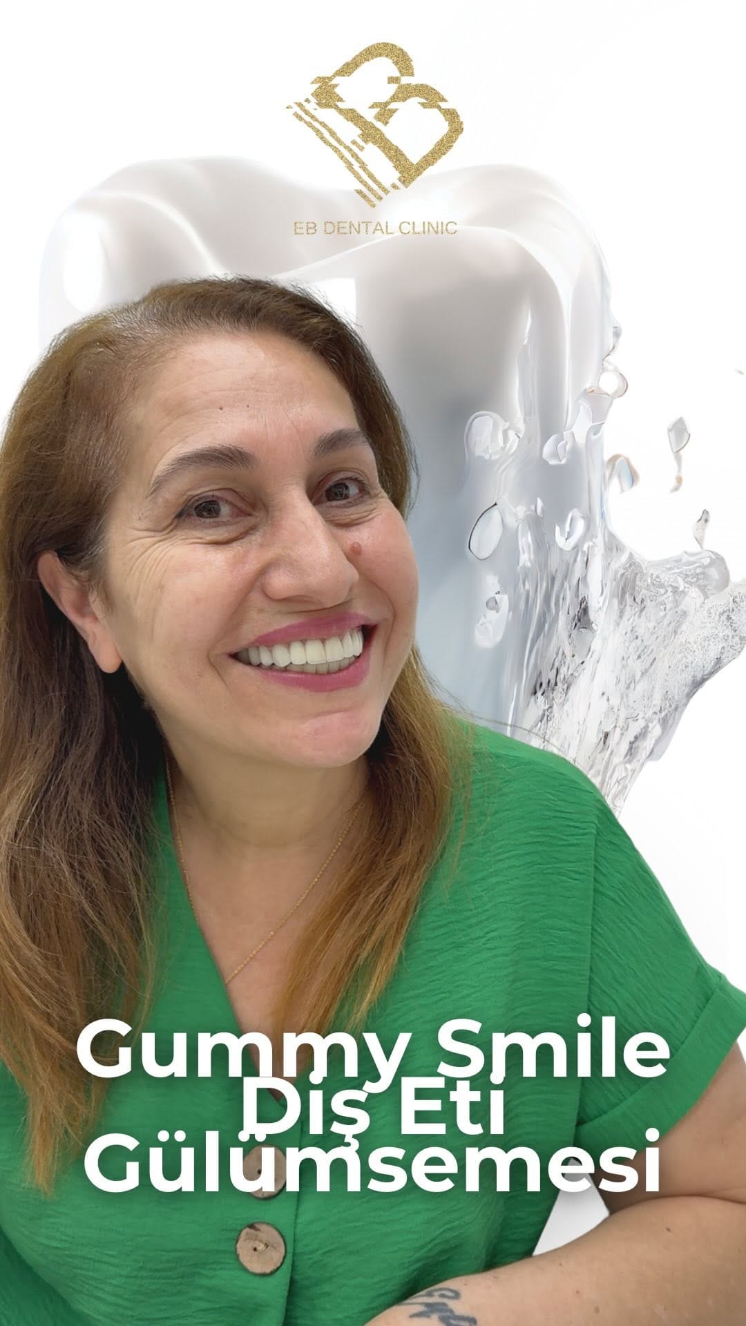 Post 7 by Dr Dr Esra Bozbay Özsoy on Instagram (video)