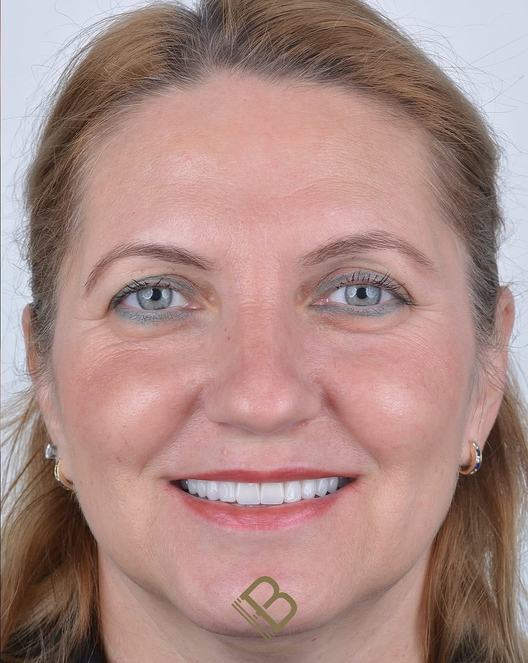 Post 2 by Dr Dr Esra Bozbay Özsoy on Instagram (carousel)