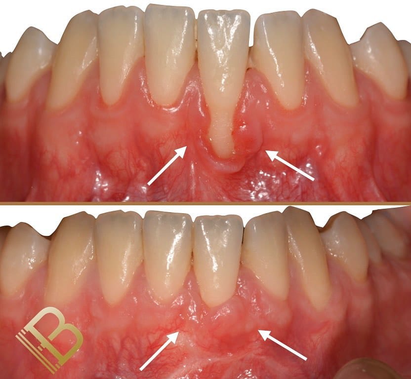 Post 10 by Dr Dr Esra Bozbay Özsoy on Instagram (image)