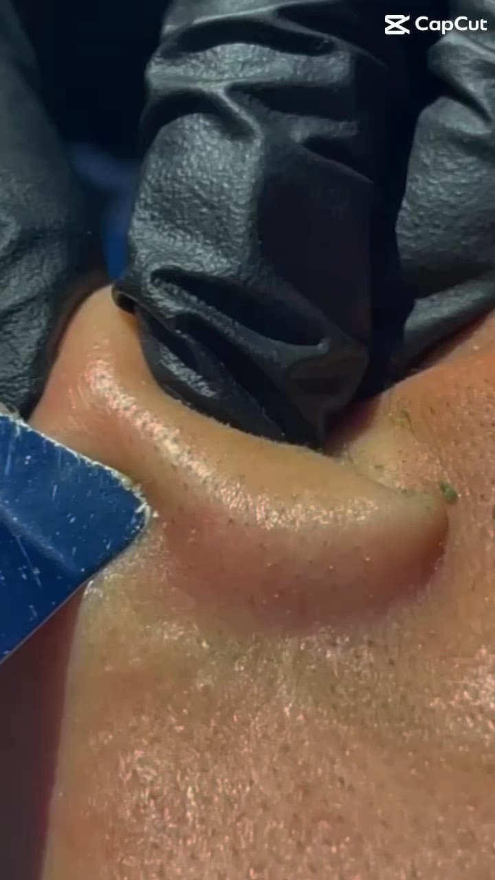 Post 3 by TradisionalSpa TangkakMuarMelakaJB on Instagram (video)