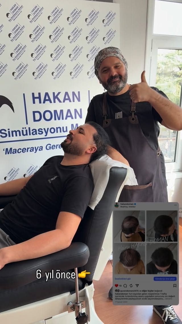 Post 8 by Saç simülasyonu uzmanı  SMP on Instagram (video)