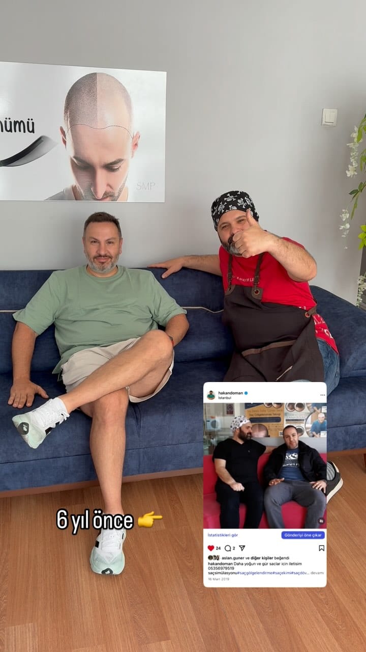 Post 9 by Saç simülasyonu uzmanı  SMP on Instagram (video)