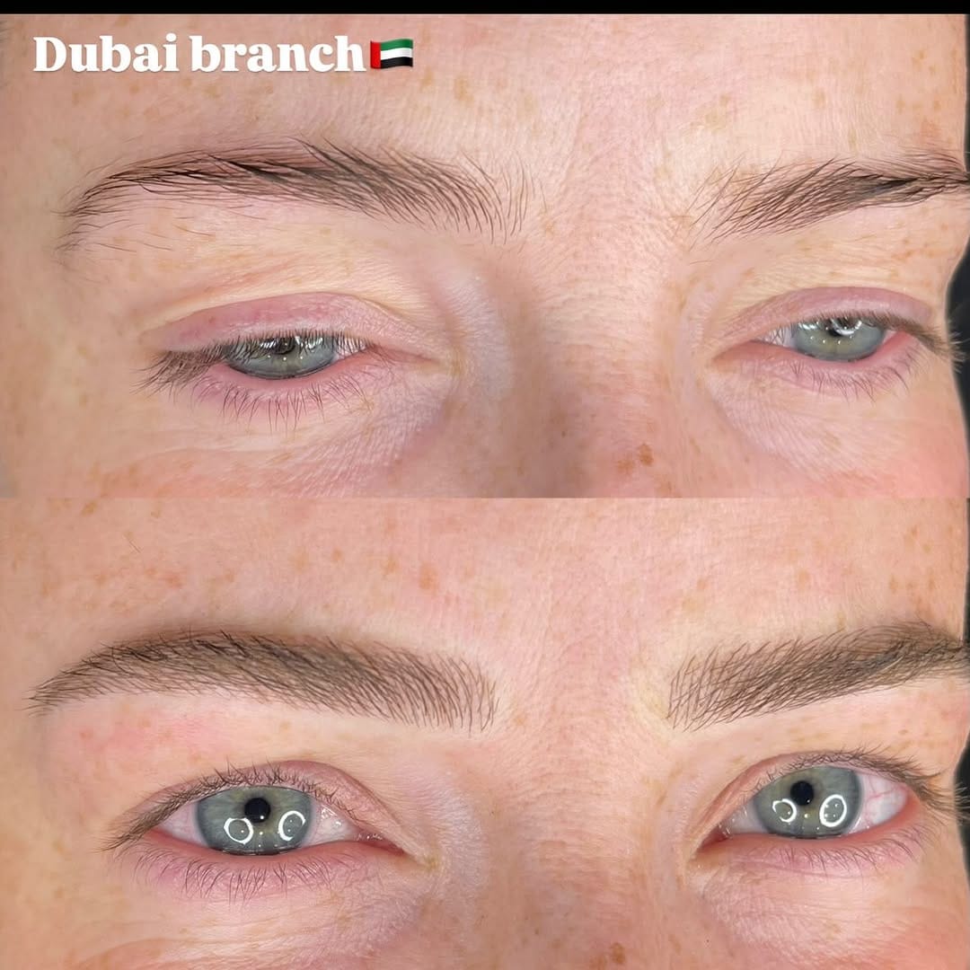 Post 6 by Brazilian Beauty Center on Instagram (image)