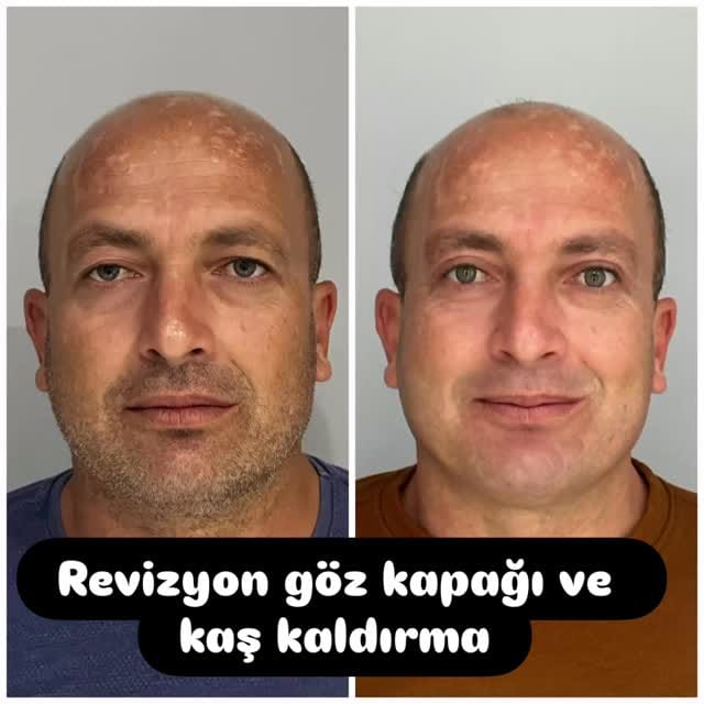 Post 5 by Umut Kaygusuz on Instagram (video)
