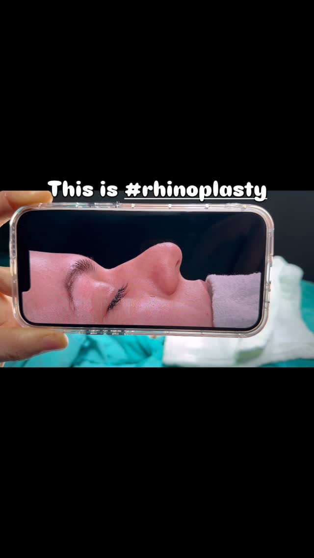 Post 4 by Umut Kaygusuz on Instagram (video)
