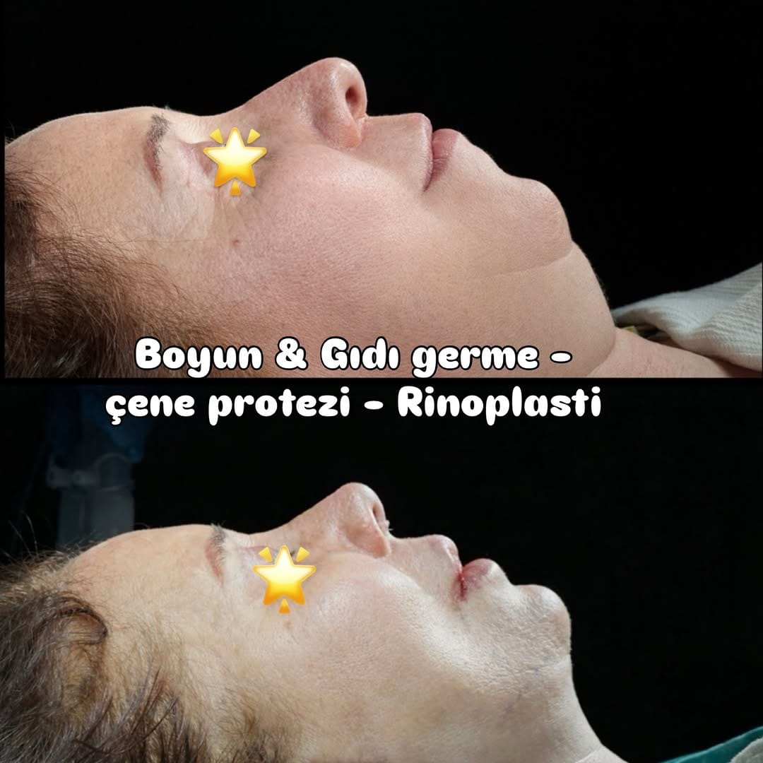 Post 2 by Umut Kaygusuz on Instagram (image)