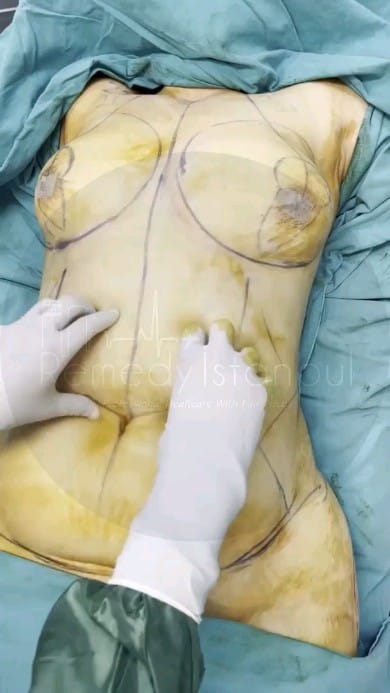 Post 9 by Remedy Istanbul on Instagram (video)