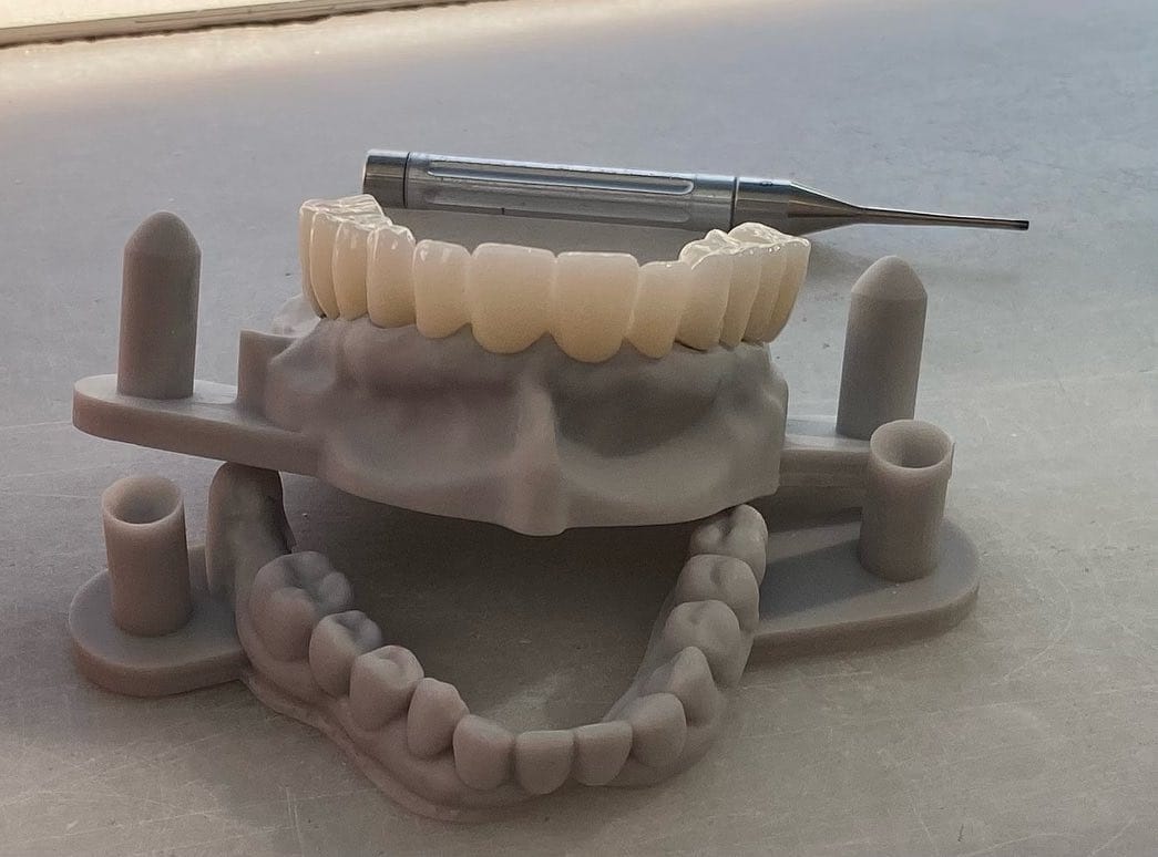 Post 10 by VERA DİŞ PROTEZ LABORATUVARI on Instagram (carousel)