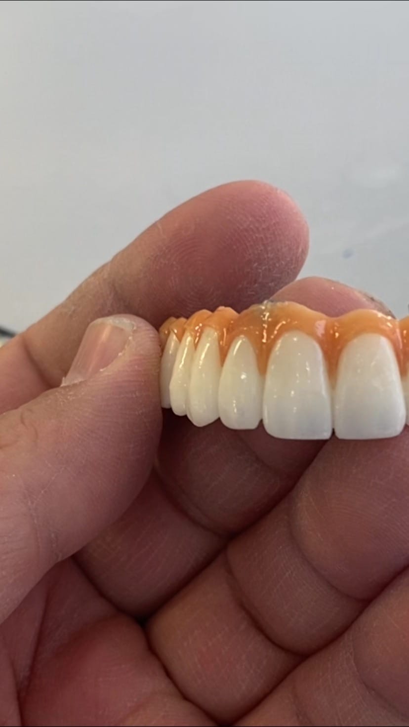Post 5 by VERA DİŞ PROTEZ LABORATUVARI on Instagram (video)