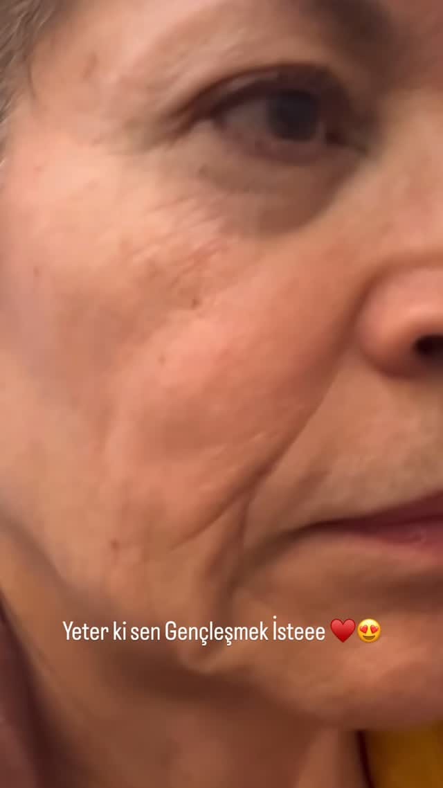 Post 5 by UZM.COSMETOLOGYST BÜŞRA EROĞLU on Instagram (video)