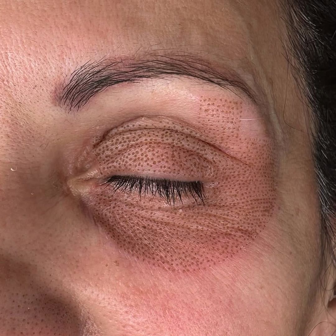 Post 4 by UZM.COSMETOLOGYST BÜŞRA EROĞLU on Instagram (image)