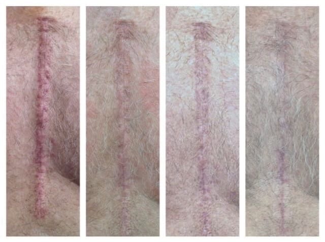 Post 2 by UZM.COSMETOLOGYST BÜŞRA EROĞLU on Instagram (image)