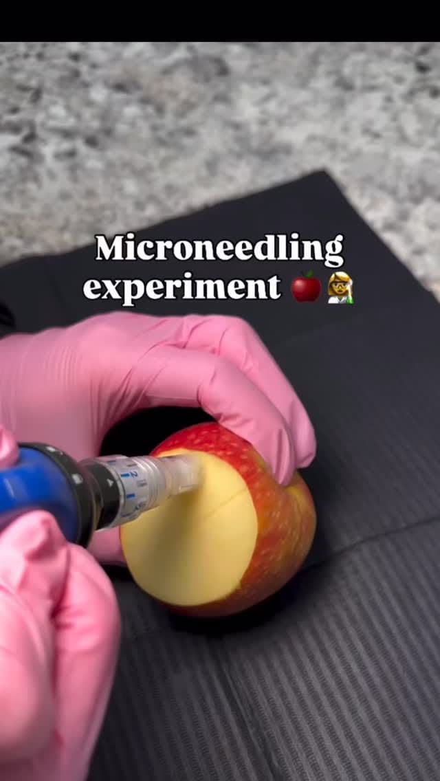 Post 6 by UZM.COSMETOLOGYST BÜŞRA EROĞLU on Instagram (video)