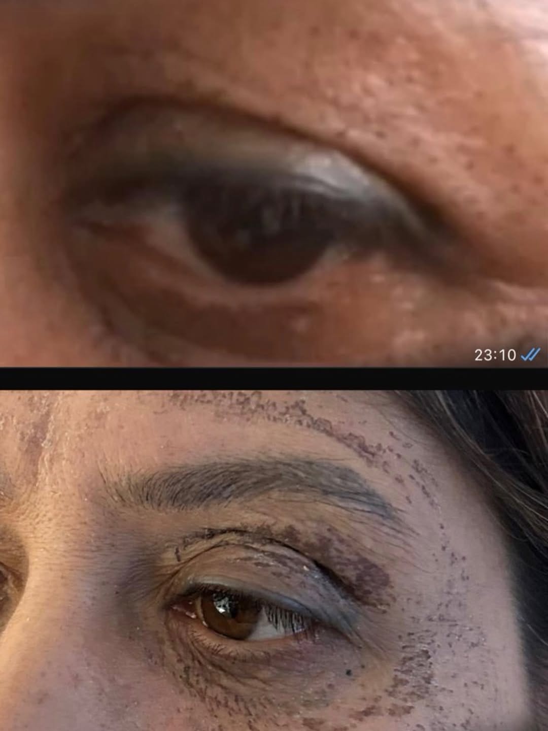 Post 3 by UZM.COSMETOLOGYST BÜŞRA EROĞLU on Instagram (carousel)
