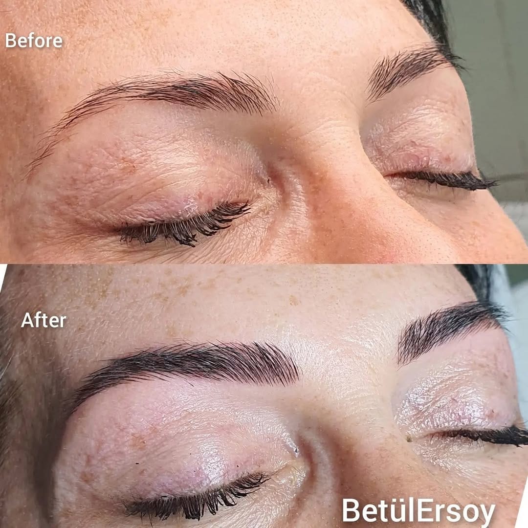 Post 4 by Betül Ersoy on Instagram (image)