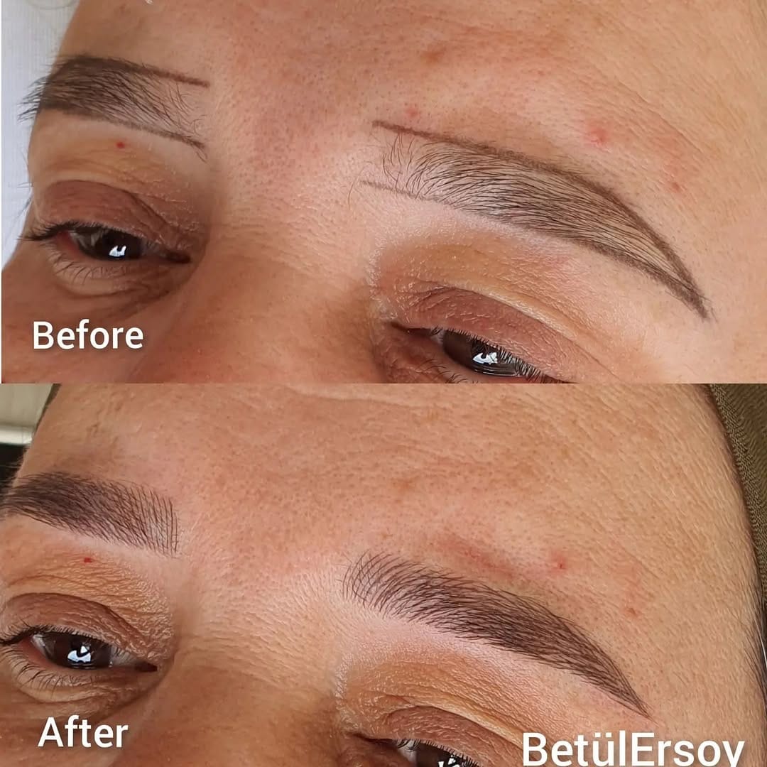 Post 8 by Betül Ersoy on Instagram (image)