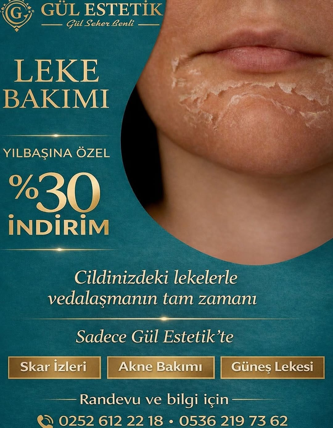 Post 7 by Gül  Estetik on Instagram (image)