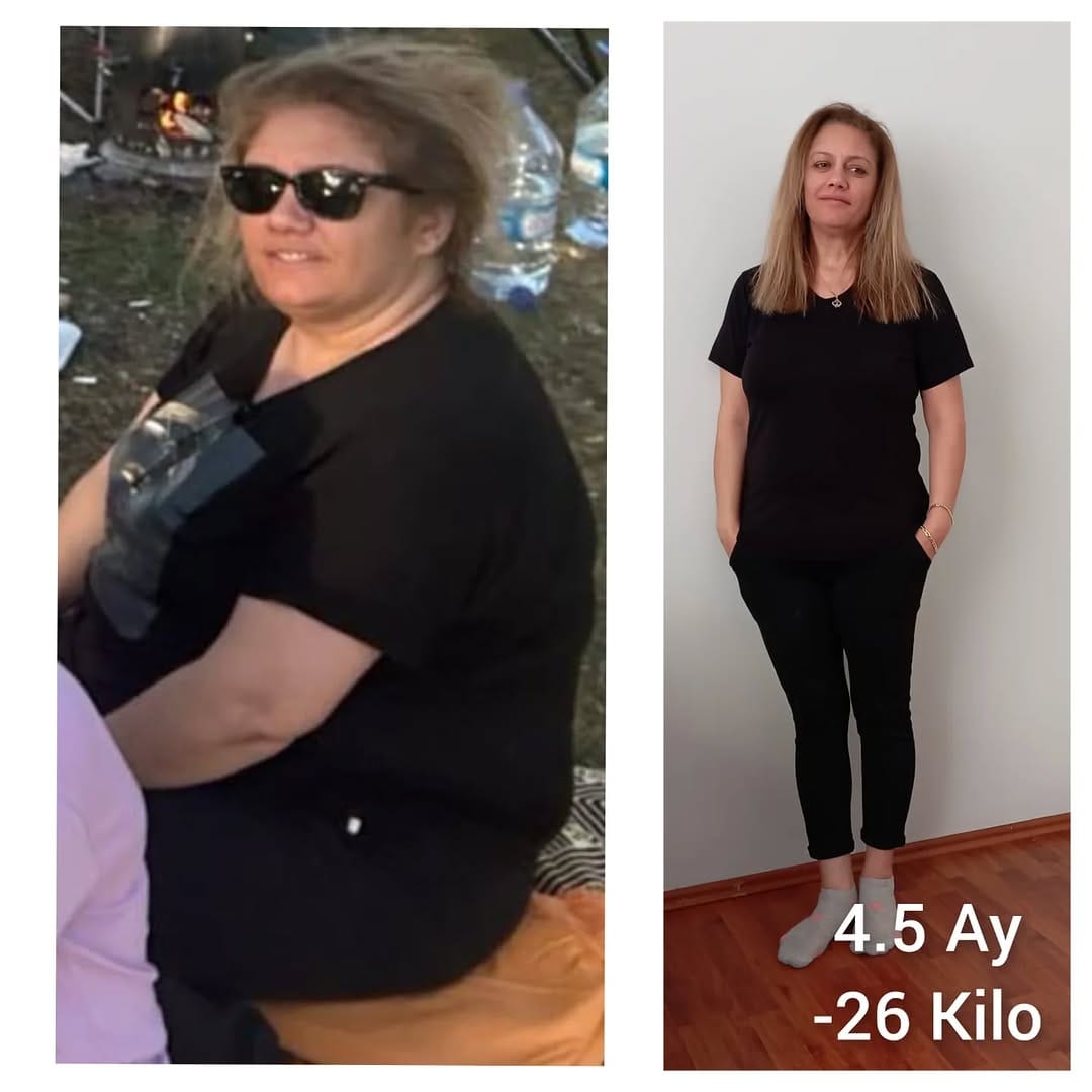 Post 1 by Terapötik Beslenme Diyetisyeni on Instagram (image)