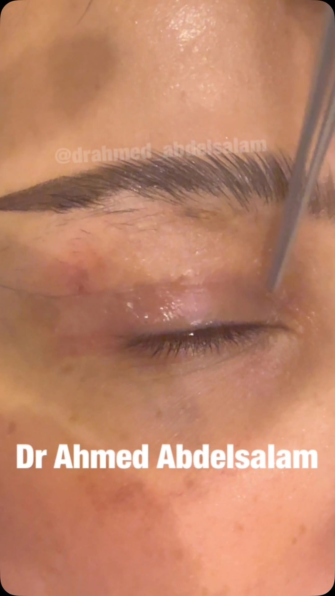 Post 9 by Ahmed Abdel Salam Attia on Instagram (video)
