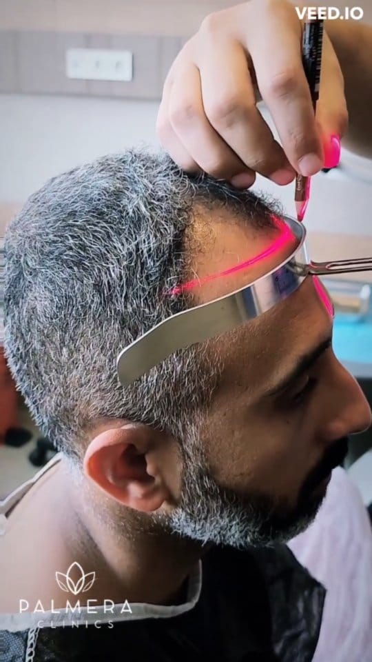 Post 7 by palmera clinic on Instagram (video)