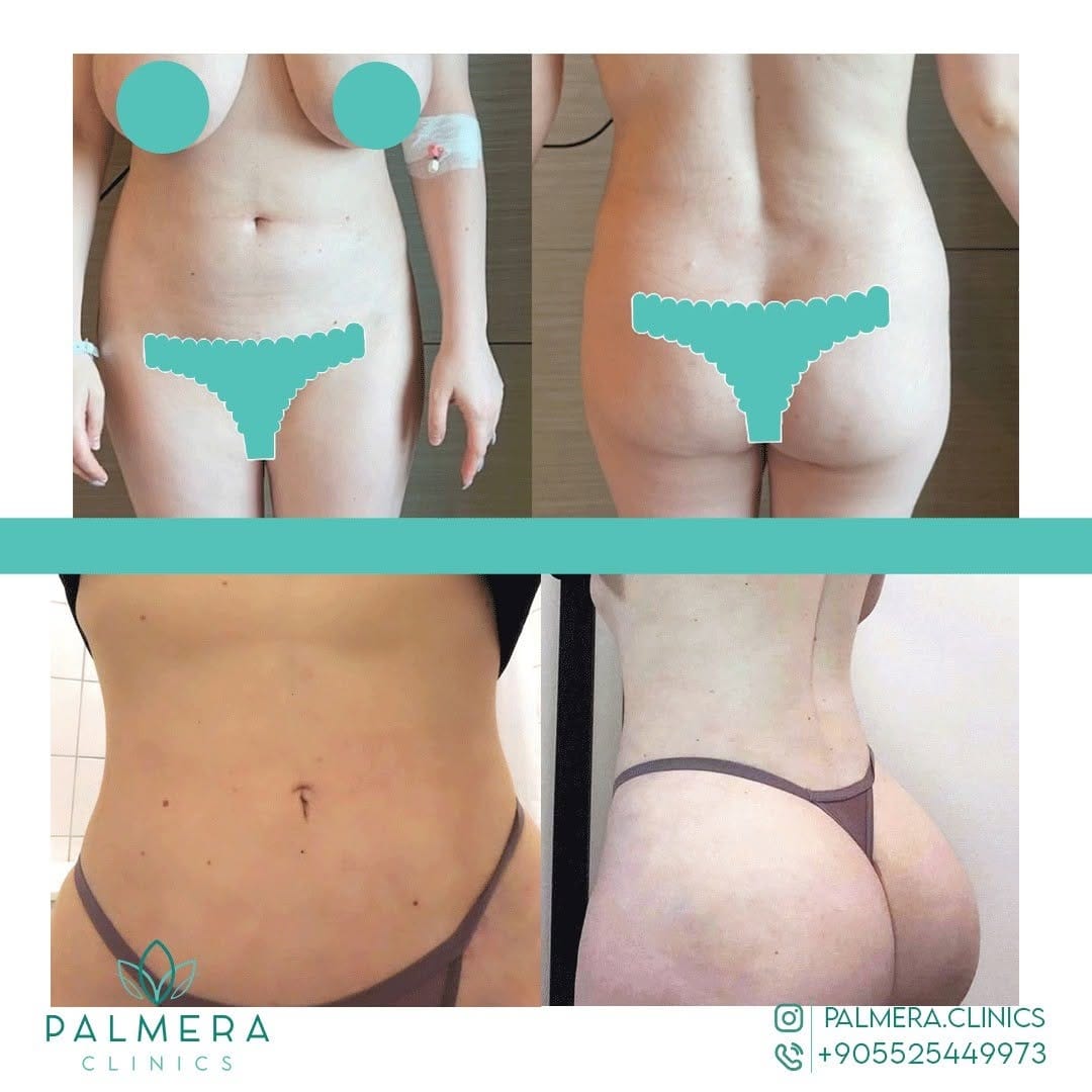 Post 8 by palmera clinic on Instagram (image)