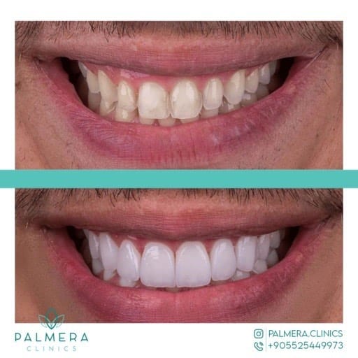 Post 6 by palmera clinic on Instagram (image)