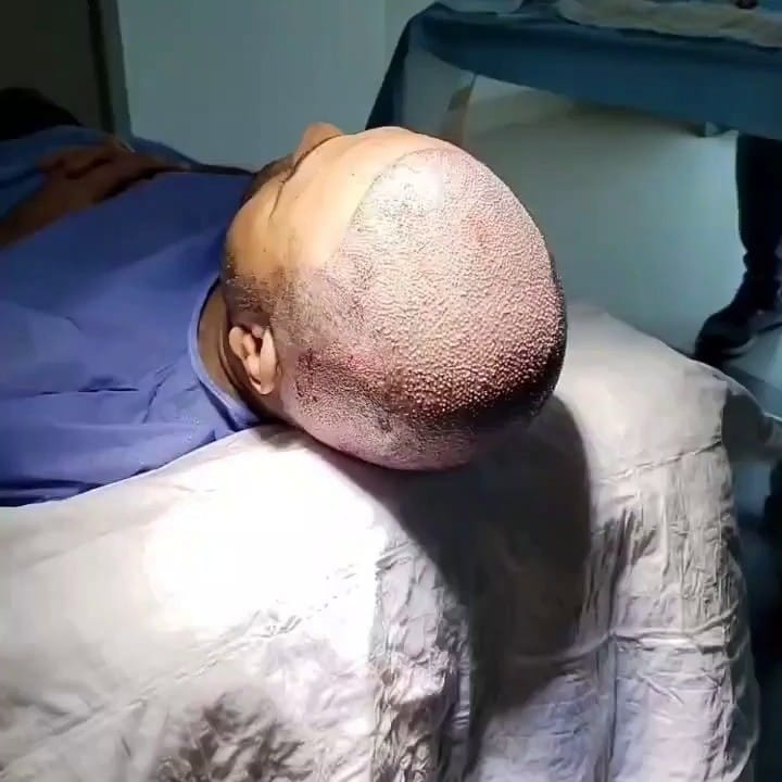Post 10 by palmera clinic on Instagram (video)