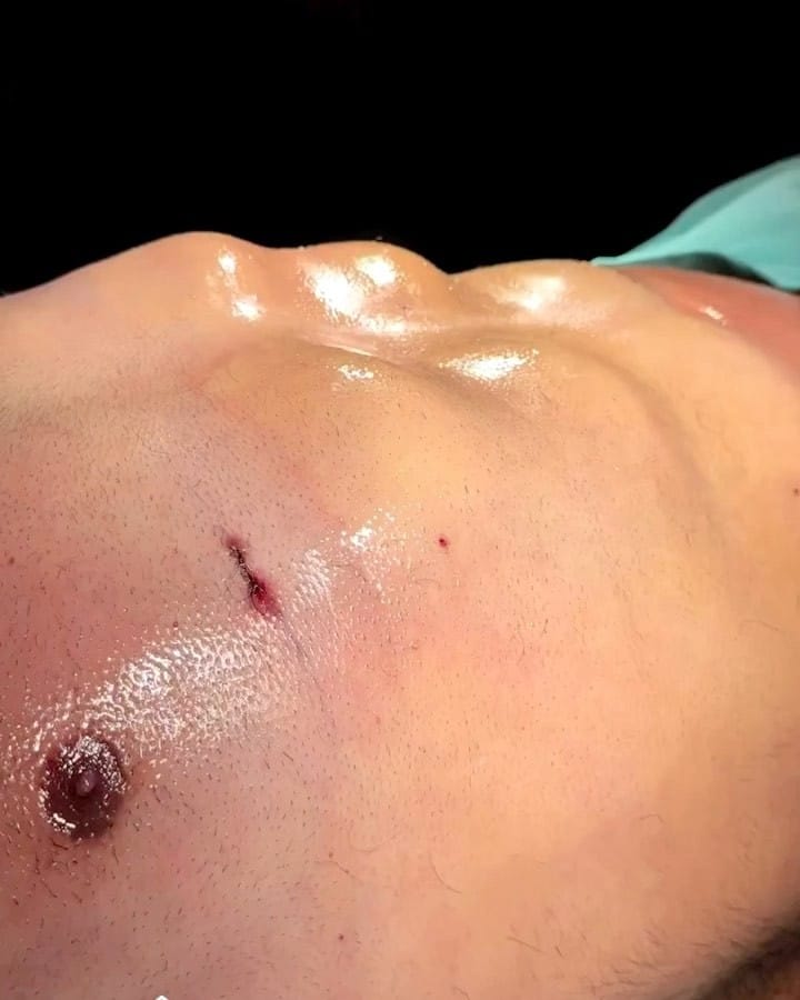 Post 5 by palmera clinic on Instagram (video)