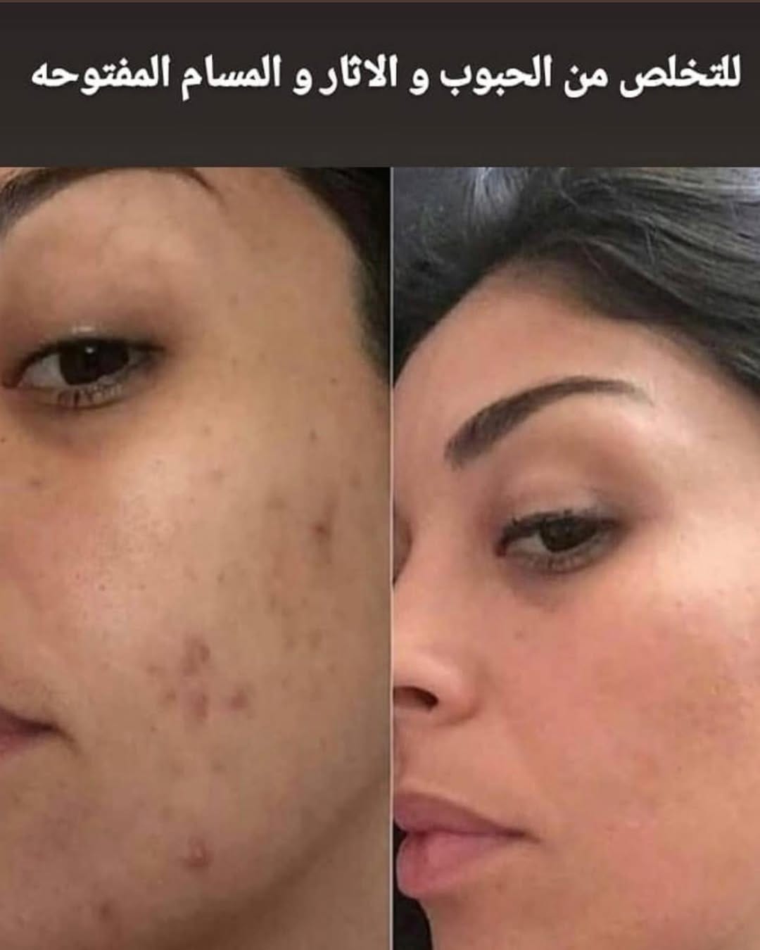 Post 3 by Jeunesse Middle East 🩺 on Instagram (image)