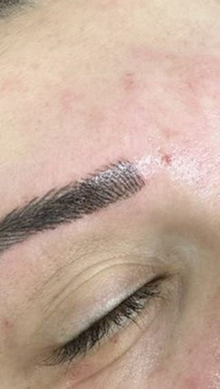 Post 4 by Reyhan Yargıcı Cilt Ve Güzellik Uzmanı on Instagram (video)