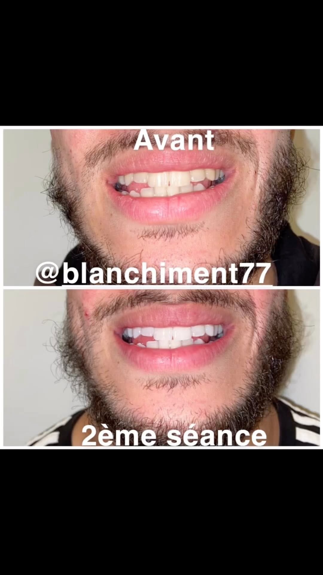 Post 3 by blanchiment 77 on Instagram (video)