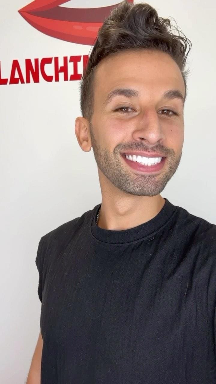 Post 4 by blanchiment 77 on Instagram (video)