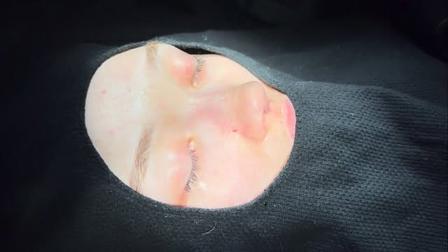 Post 2 by Op. Dr. Şahnur Güler on Instagram (video)