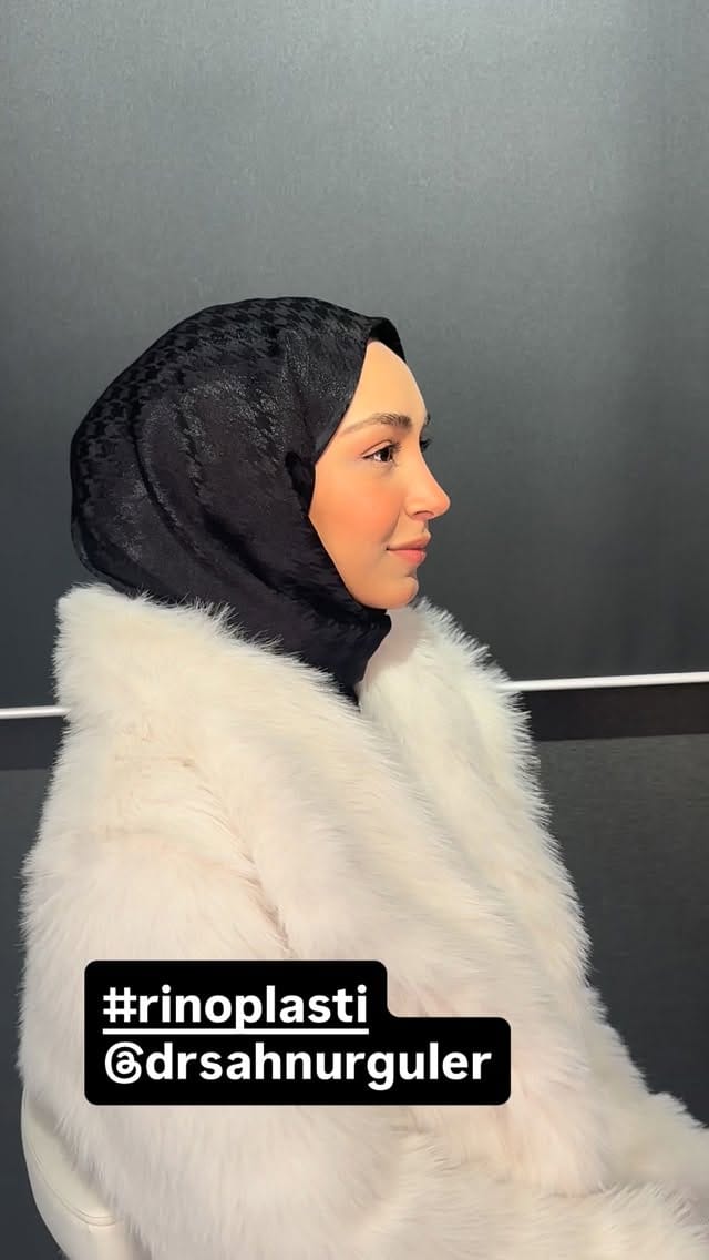 Post 9 by Op. Dr. Şahnur Güler on Instagram (video)