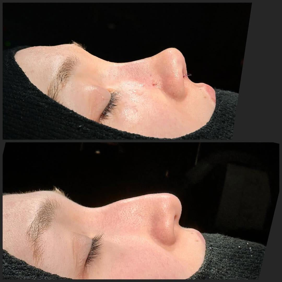 Post 1 by Op. Dr. Şahnur Güler on Instagram (carousel)