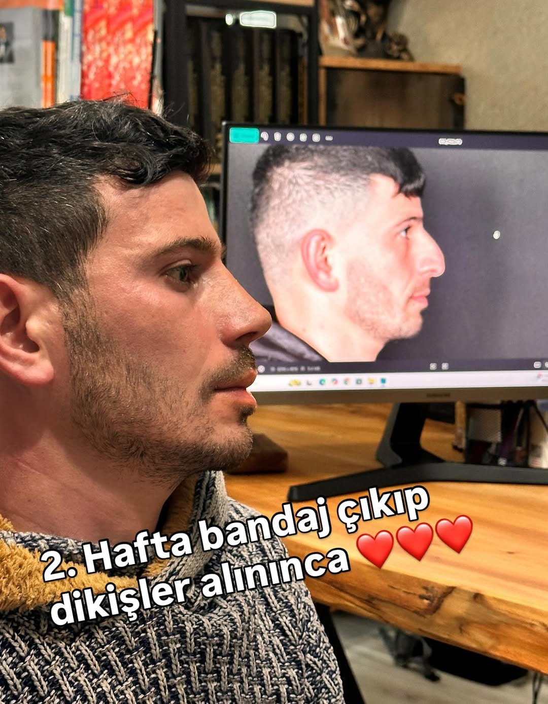 Post 10 by Op. Dr. Şahnur Güler on Instagram (image)