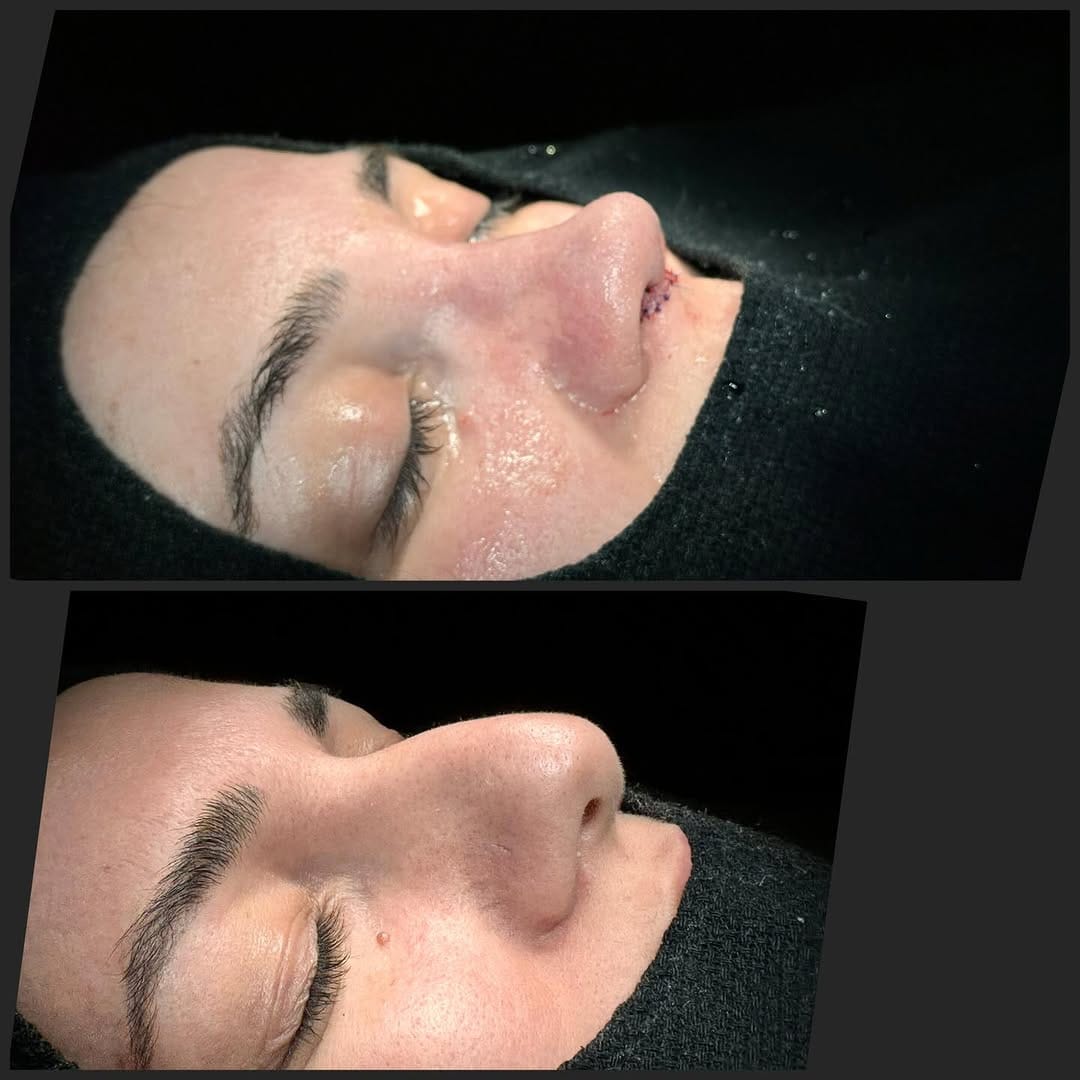 Post 5 by Op. Dr. Şahnur Güler on Instagram (carousel)