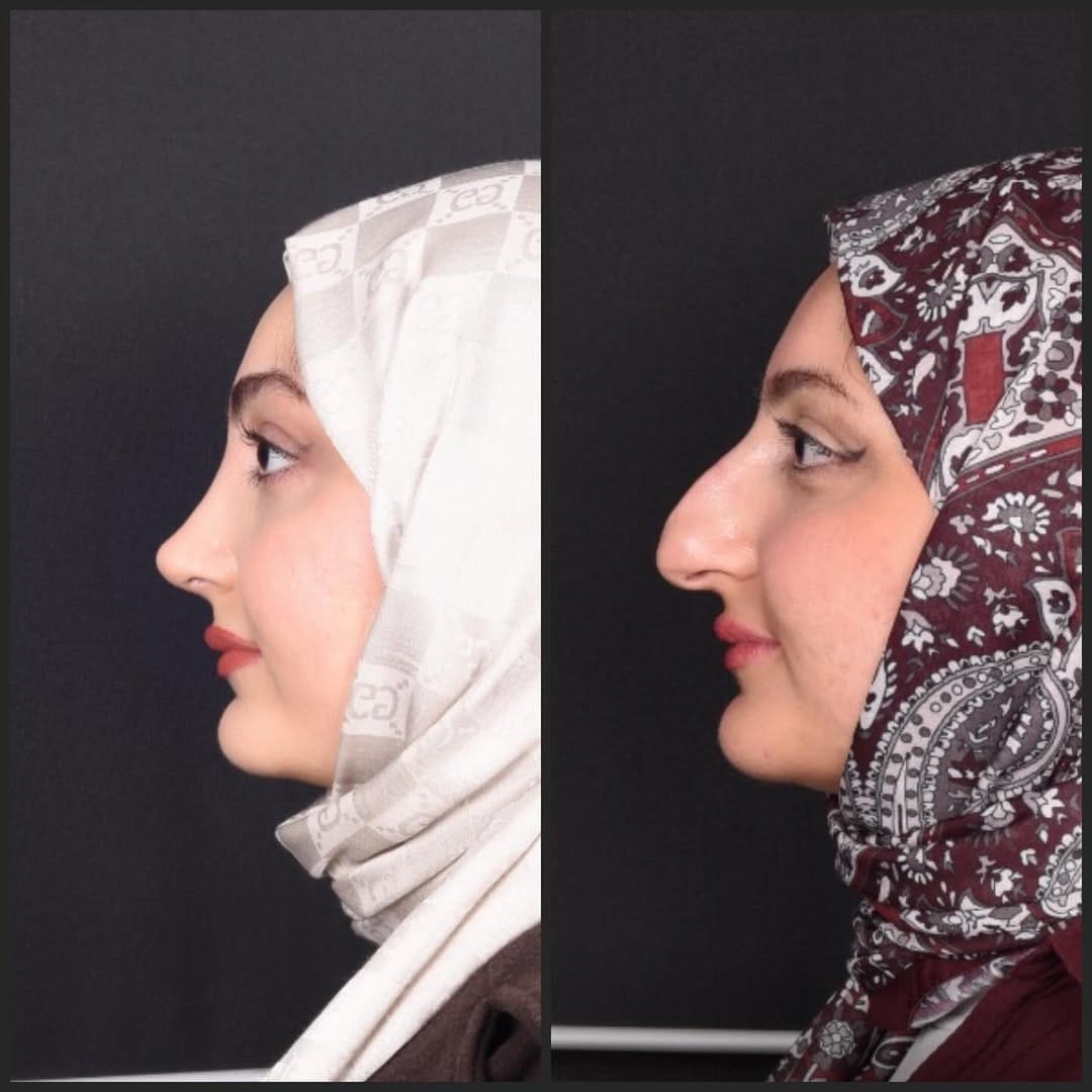 Post 4 by Op. Dr. Şahnur Güler on Instagram (carousel)