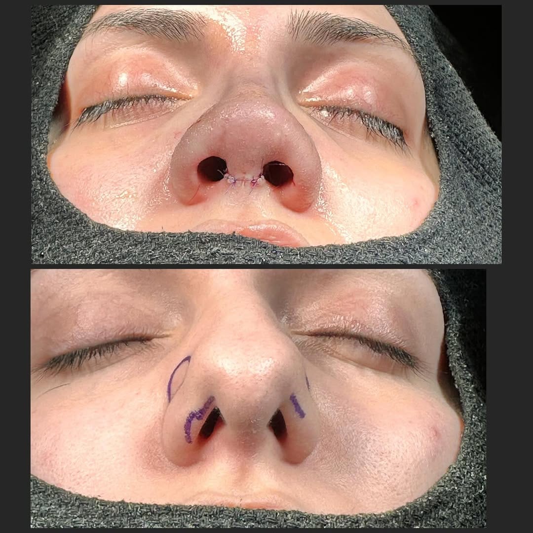 Post 3 by Op. Dr. Şahnur Güler on Instagram (carousel)