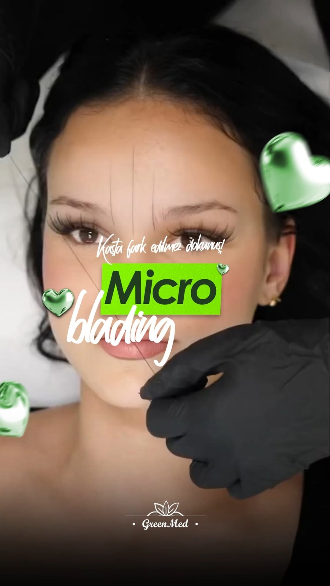 Post 1 by Greenmed Güzellik Salonu -İzmit on Instagram (video)