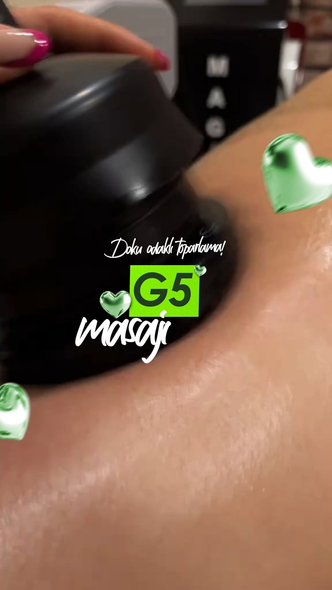 Post 4 by Greenmed Güzellik Salonu -İzmit on Instagram (video)