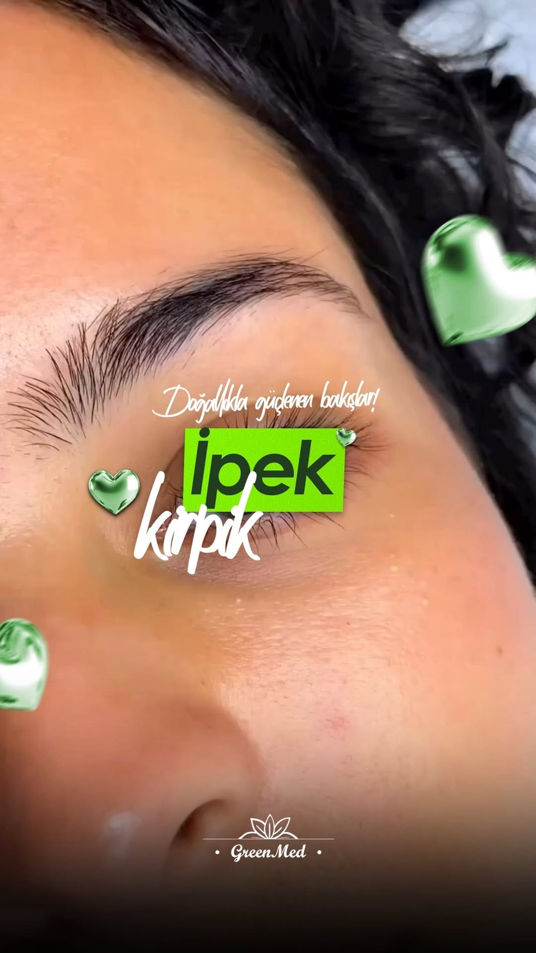 Post 7 by Greenmed Güzellik Salonu -İzmit on Instagram (video)
