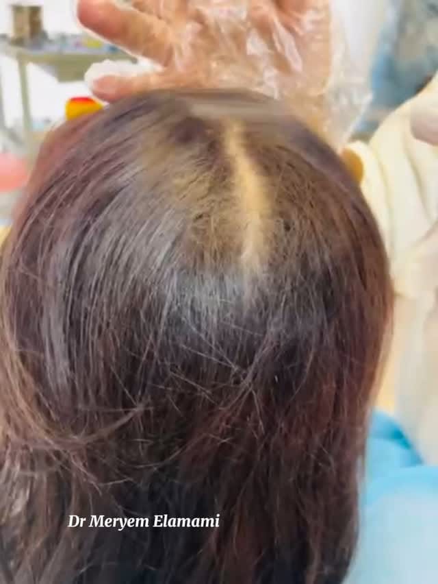 Post 7 by Dr.Mariam Elamami on Instagram (video)