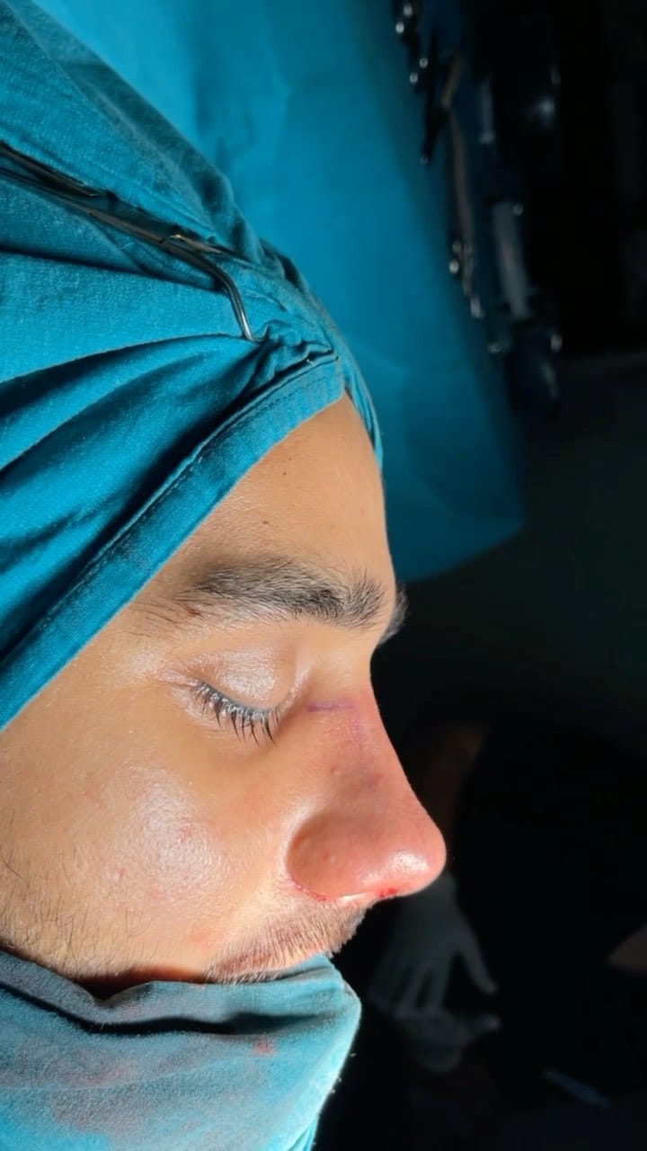 Post 1 by Bi Hospital Esthetic Center on Instagram (video)