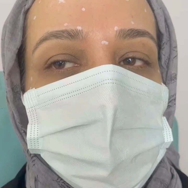 Post 9 by Bi Hospital Esthetic Center on Instagram (carousel)