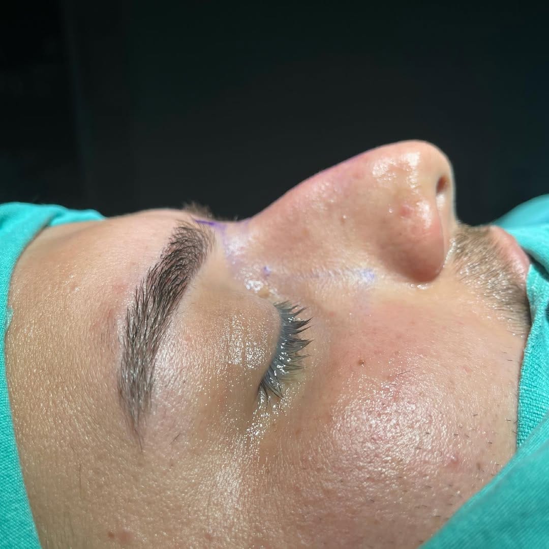 Post 6 by Bi Hospital Esthetic Center on Instagram (carousel)
