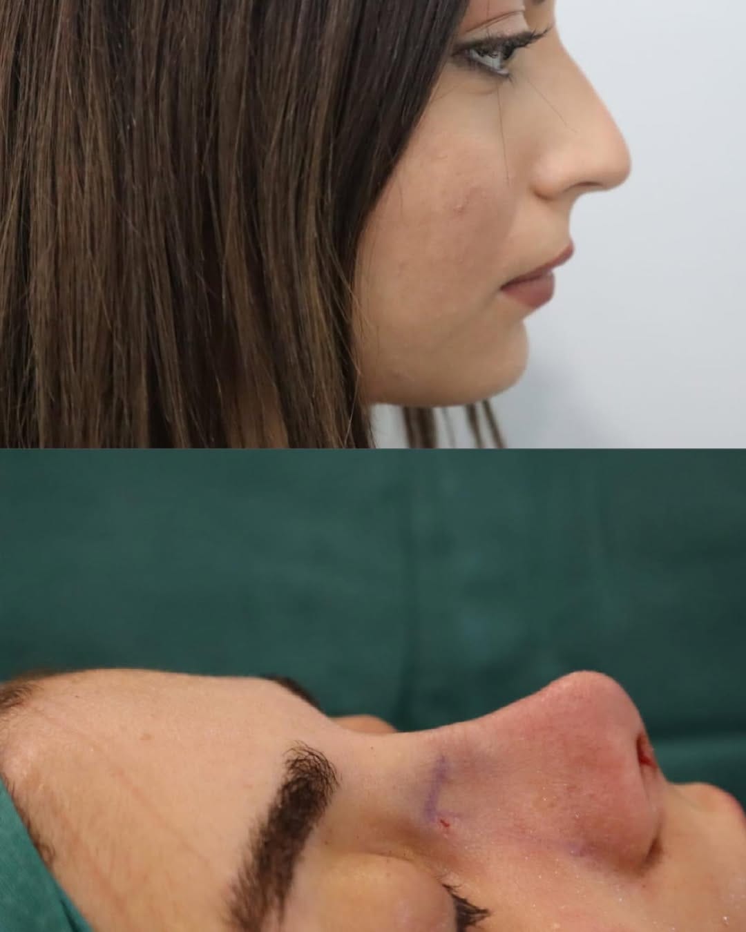 Post 7 by Bi Hospital Esthetic Center on Instagram (image)