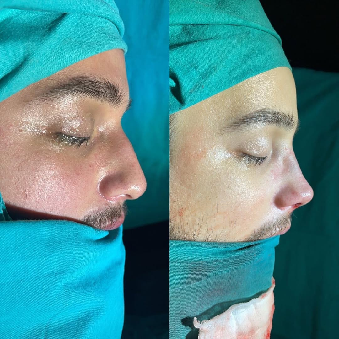 Post 5 by Bi Hospital Esthetic Center on Instagram (image)