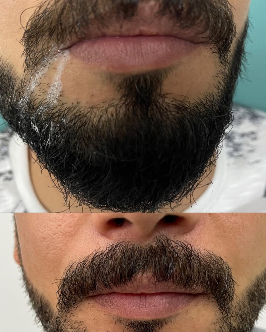 Post 8 by Bi Hospital Esthetic Center on Instagram (image)